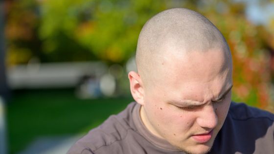 Shaved Head