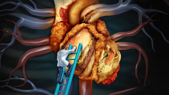 Ayurveda Treatment For Cholesterol