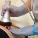 Is Laser Treatment Painful